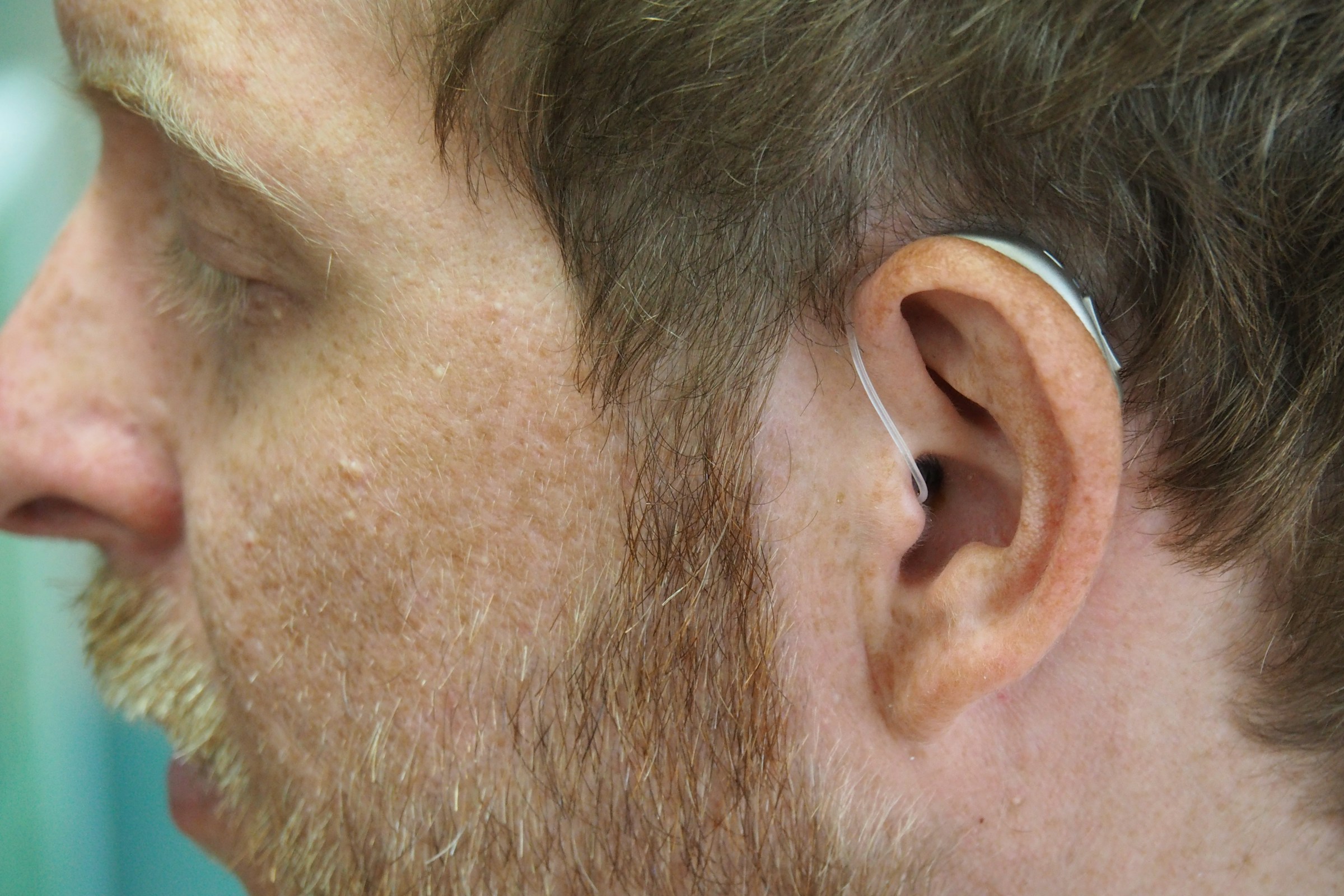 FCC Mandates Hearing Aid Compatibility for All Smartphones