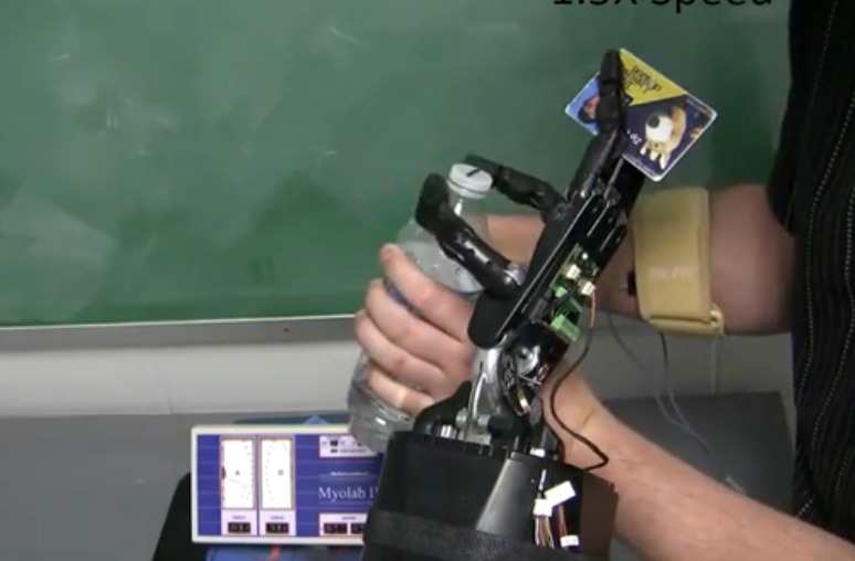 Prosthetic Hands Get Major Upgrade—Users Can Now Grasp Two Objects at Once